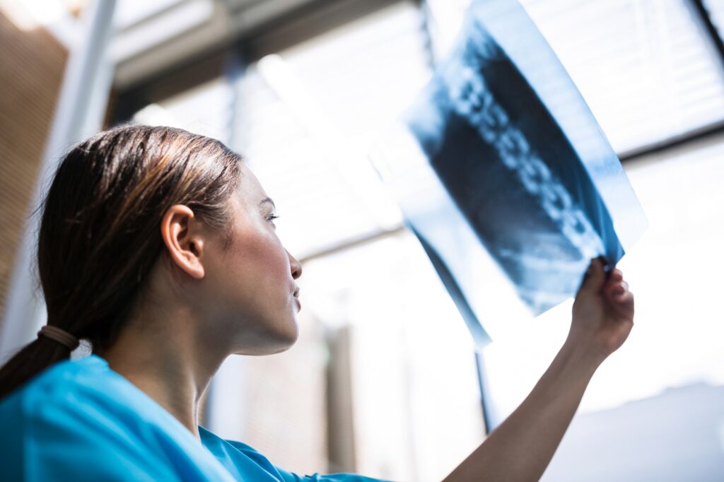 Nurse examining X-ray report